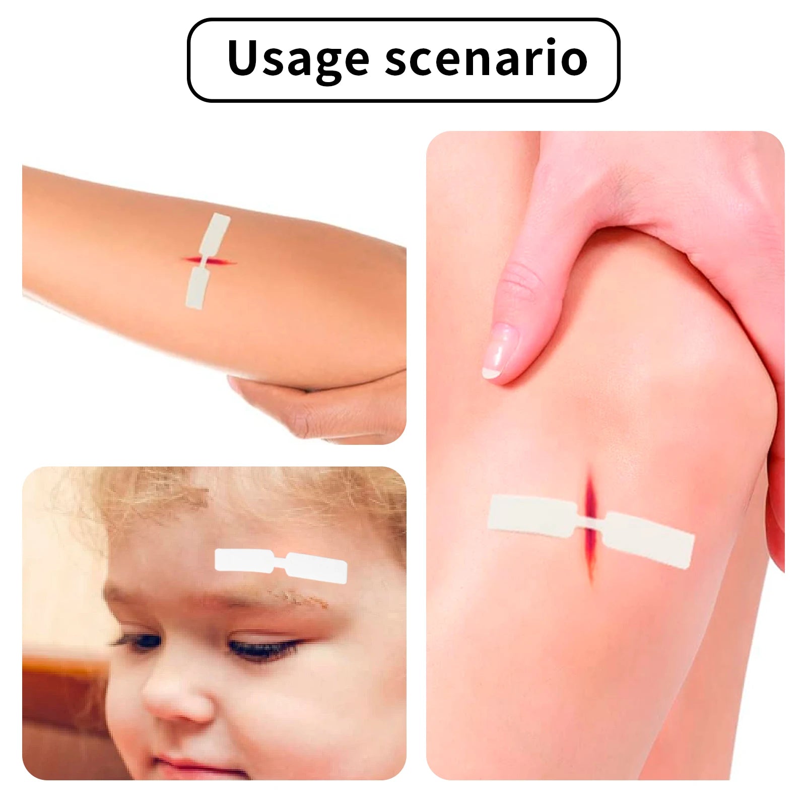 120PCS 1cmX4.5cm Kleine Waterdichte hecht pleister Vlinder Zelfklevende Wond Sluiting Band Aid Noodkit Zelfklevende Verbanden - survivor's choice Default Title survivor's choice